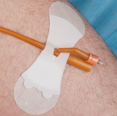 Grip Lok Large Non-Sterile